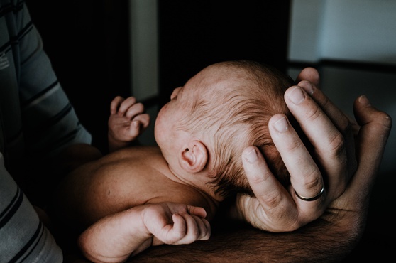 Dermatite seborroica neonato: cosa è? Come si manifesta? Come trattarla?